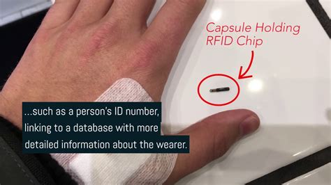 impact of rfid chips in children|Human Microchipping: The Benefits an.